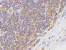 B7.2(CD86)